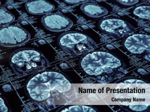 Magnetic Resonance Imaging PowerPoint Template