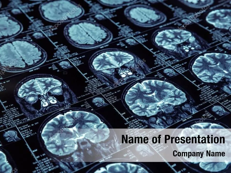 Magnetic Resonance Imaging