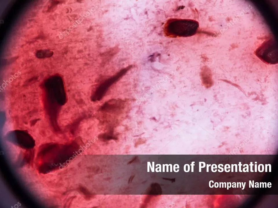 Virus Under An Electron Microscope