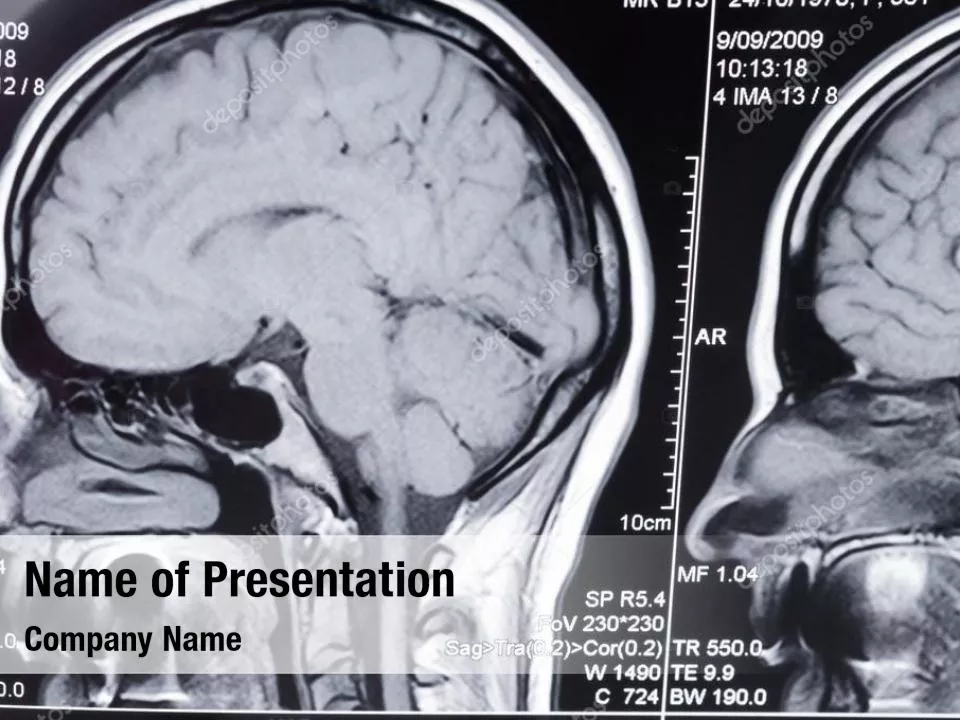 Brain Tomography Slice