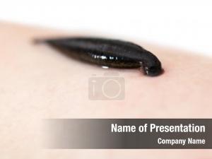 Leeches Therapy PowerPoint Template