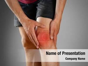 Joint Ache PowerPoint Template