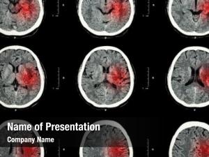 Red scan brain area imaging PowerPoint Template