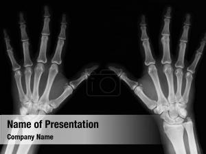 Adult x rays hands man visible