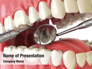 Caries PowerPoint Template