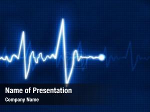 Cardiogram