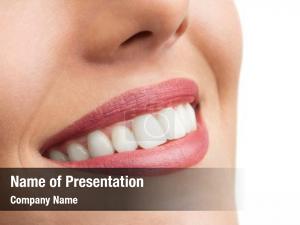 Teeth Whitening