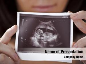 Ultrasound woman holding picture her