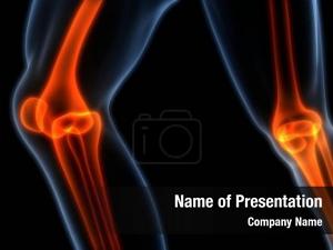 Bones human body joint pains