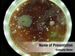Colonies growing bacterial petri dish