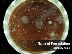 Colonies growing bacterial petri dish
