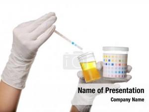 Test reagent strip urinalysis 