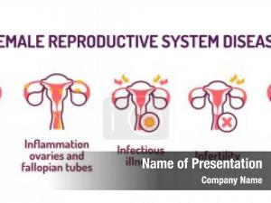 Uterus line