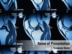 Sport knee mri trauma, damage PowerPoint Template