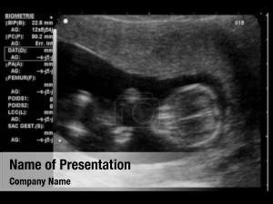 Weeks ultrasound fetus  
