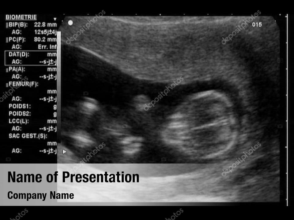 ultrasound-sonogram-powerpoint-template-ultrasound-sonogram