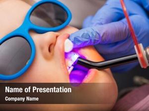 Dental dentist performing filling procedure