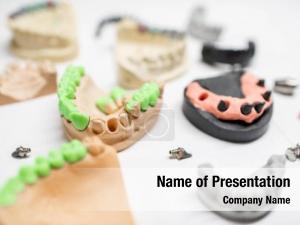 Prosthesis models denture production dental PowerPoint Template