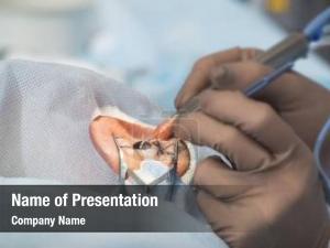 Surgical treatment cataract method 