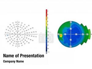  visual eye test field glaucoma