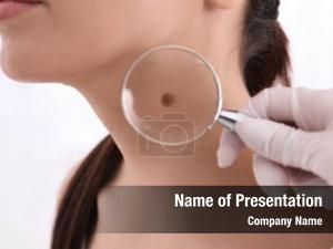 Dermatologist with magnifier powerpoint theme