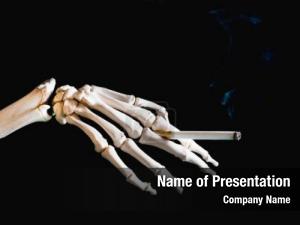 Skeleton Hand