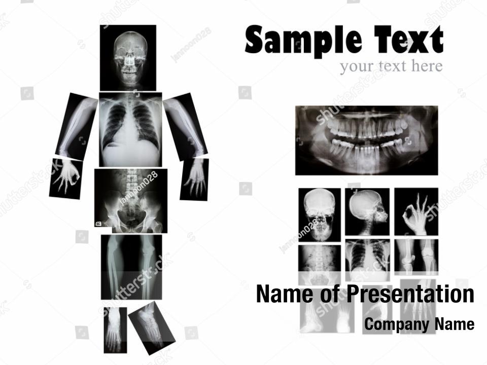 x-ray-human-chest-powerpoint-template-x-ray-human-chest-powerpoint