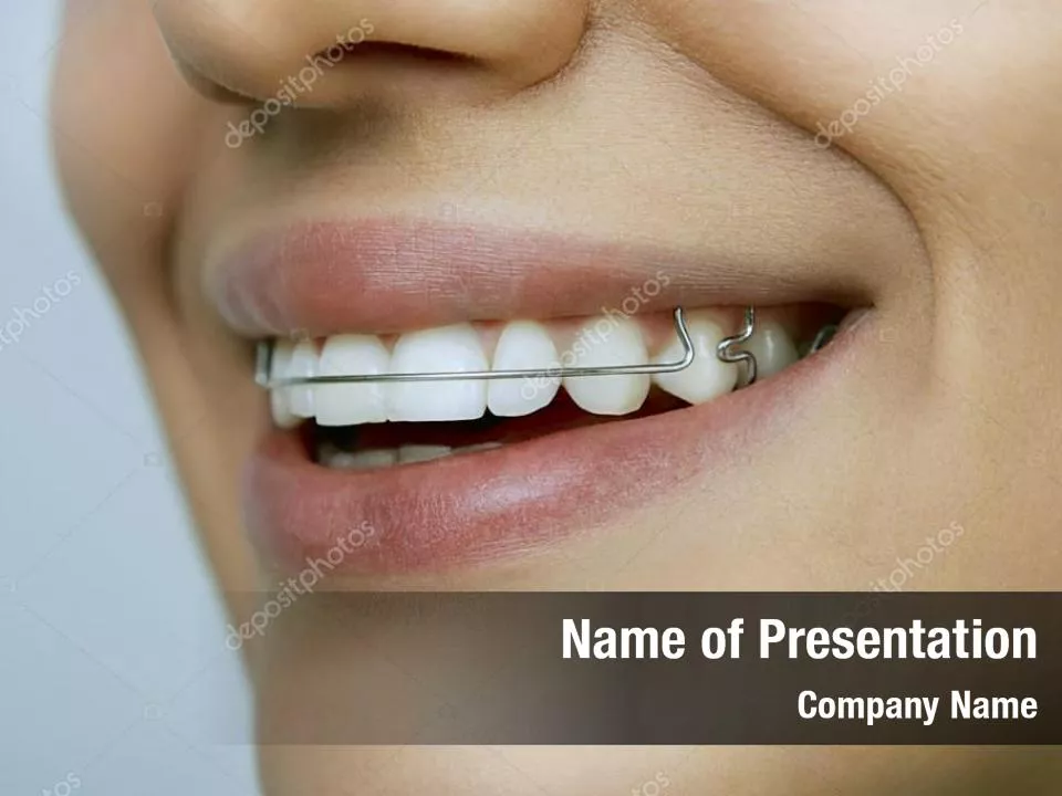 Orthodontic Plate PowerPoint Template Orthodontic Plate PowerPoint 