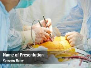Perform team surgeon heart transplantation