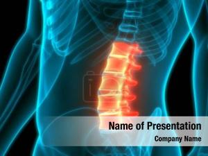Vertebrae PowerPoint Template