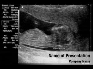 Weeks ultrasound fetus  