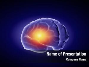 Intelligence concept human human brain