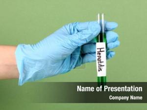 Labeled test tube hepatitis hand