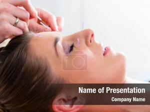 Acupuncture therapist setting needles woman