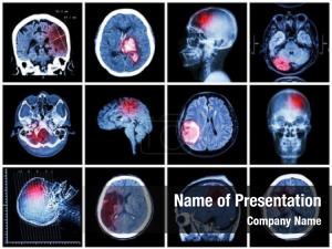 Disease collection brain scan mri