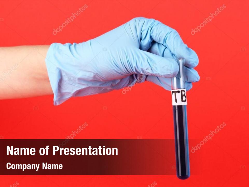 Labeled test tube tuberculosis(tb) hand