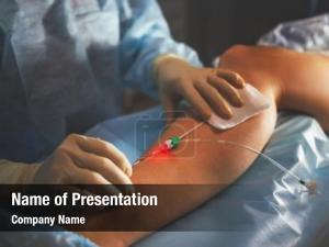 Vascular Surgery PowerPoint Template