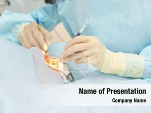 Surgery ophthalmology laser  
