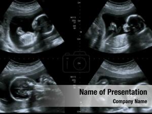 Ultrasound Collage PowerPoint Template
