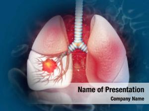 Lung Disease PowerPoint Template