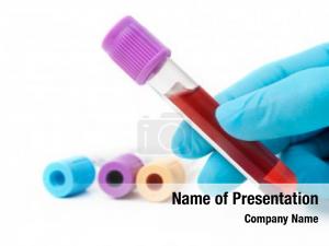 Test hand holding tube blood PowerPoint Template