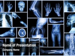 Multiple collection x ray part human