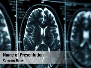MRI Examination PowerPoint Template