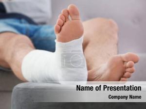 Foot Plaster