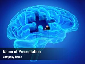 Research human brain memory loss