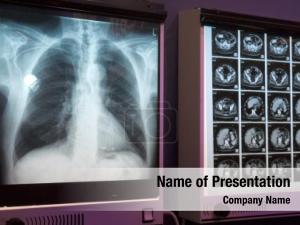 Radiograph