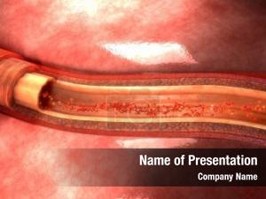 Artery PowerPoint Template