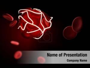 Blood Thrombus