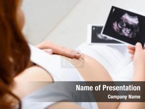 Ultrasound PowerPoint Template
