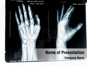 X Ray Photography PowerPoint Template